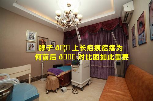 脖子 🦄 上长疤痕疙瘩为何前后 🐒 对比图如此重要